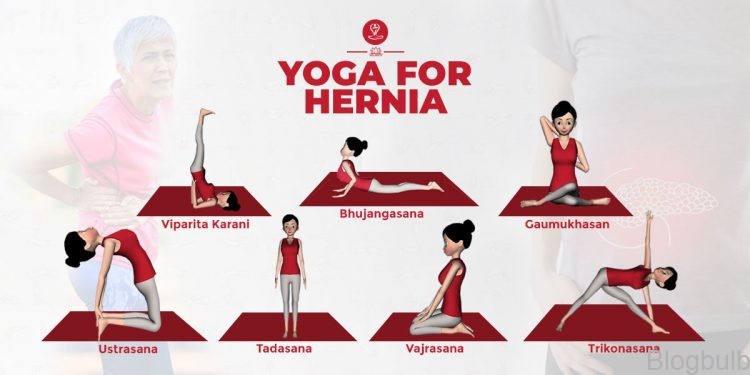 %name 10 Best Yoga Poses For Inguinal Hernia And Other Abdominal Issues