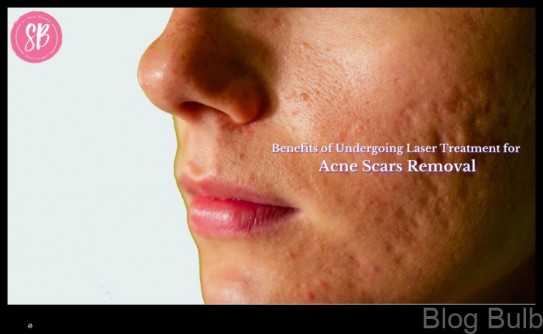 %name Laser Treatment for Acne Scars A Guide to the Benefits and Risks