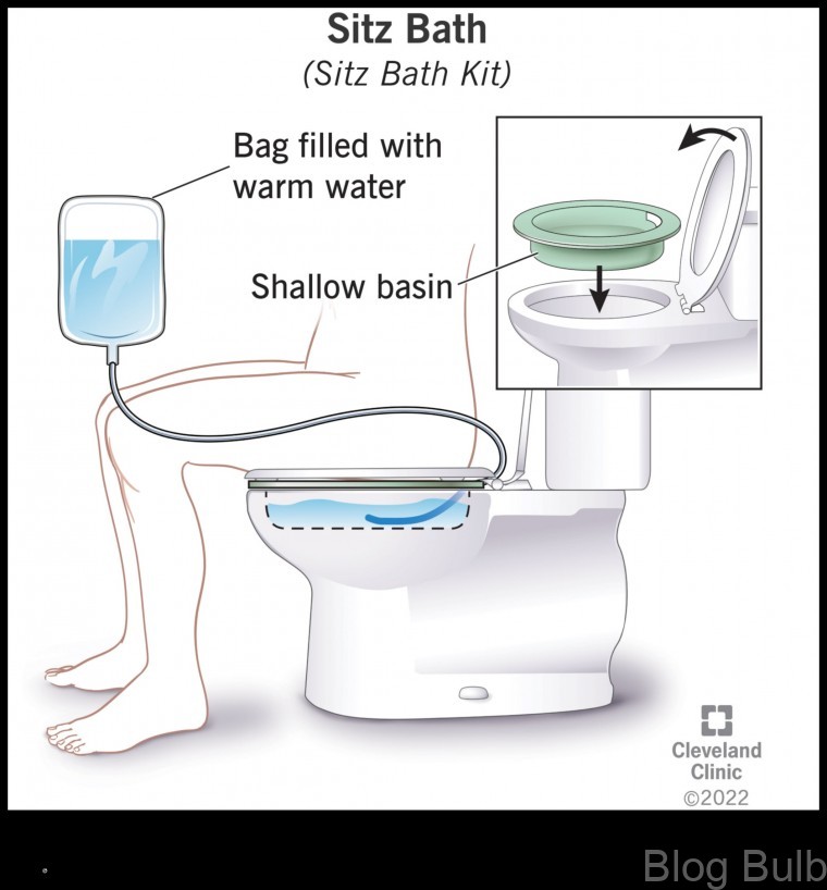 %name Sitz Bath A Simple and Effective Way to Relieve Pain and Inflammation